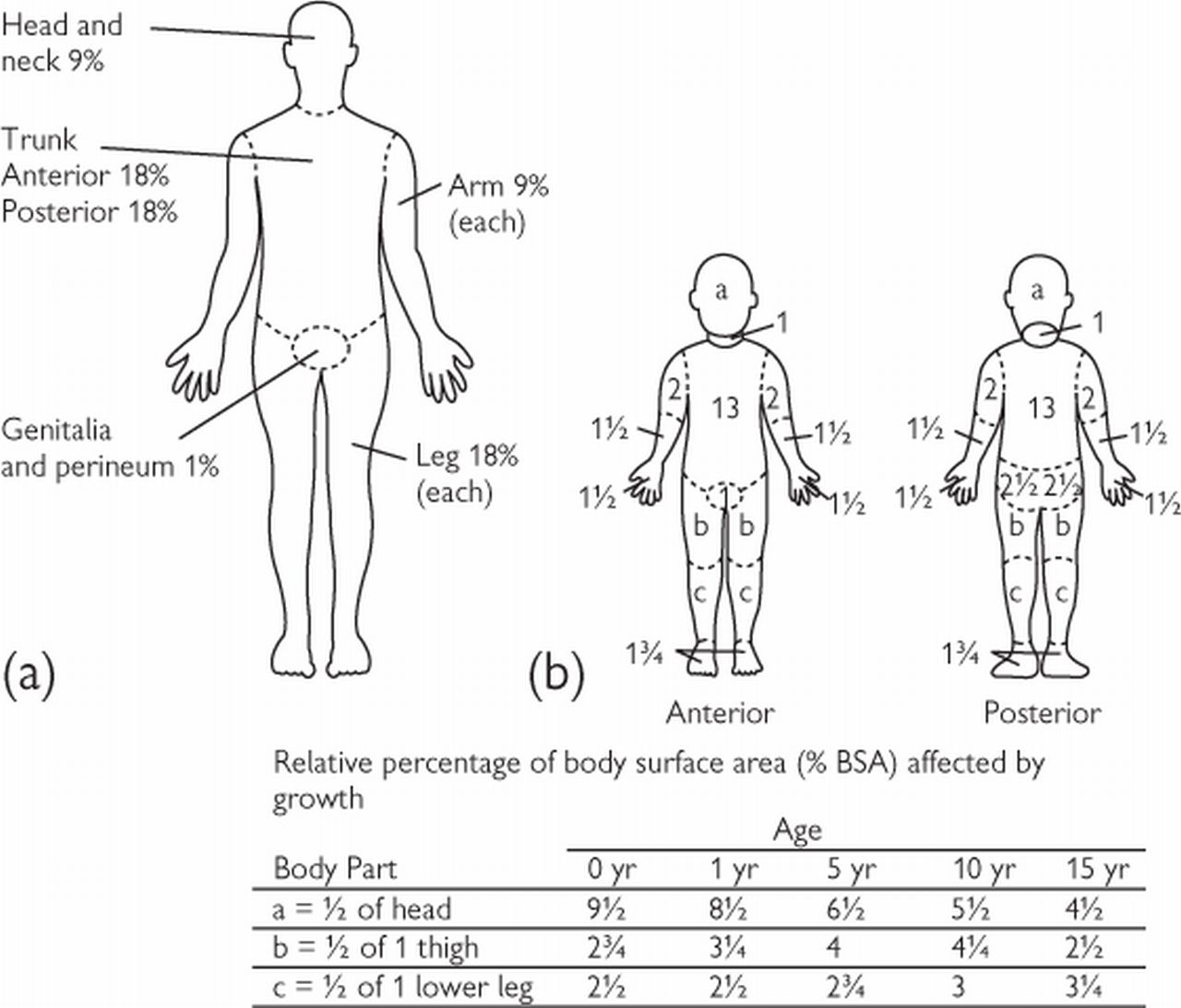 Major Burns In Children | Pediatric Emergency Playbook